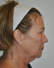 https://newportbeachcosmeticsurgeons.triplenerdscore.xyz/gallery-images/1572057516-3b9aadda-1998-4d7e-acdd-05e7afc7beb7.jpg