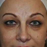 https://newportbeachcosmeticsurgeons.triplenerdscore.xyz/gallery-images/1572057535-97805a5c-2b72-4d45-9530-622d80f3e409.jpg