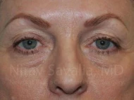 https://newportbeachcosmeticsurgeons.triplenerdscore.xyz/gallery-images/1572057576-b2672ff0-2a5a-4bd3-9dec-9cea7d2b1731.jpg