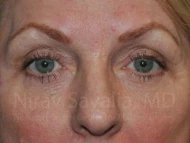 https://newportbeachcosmeticsurgeons.triplenerdscore.xyz/gallery-images/1572057579-bd8e8cbe-1066-458b-8512-d6fa58585bb0.jpg
