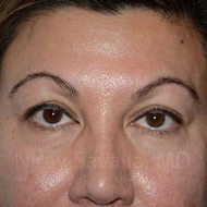 https://newportbeachcosmeticsurgeons.triplenerdscore.xyz/gallery-images/1572057738-a2eba33f-5514-4c95-9f4b-94ae7e7b6bce.jpg